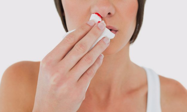 Nguyên nhân ít biết của xì mũi ra máu và cách phòng tránh